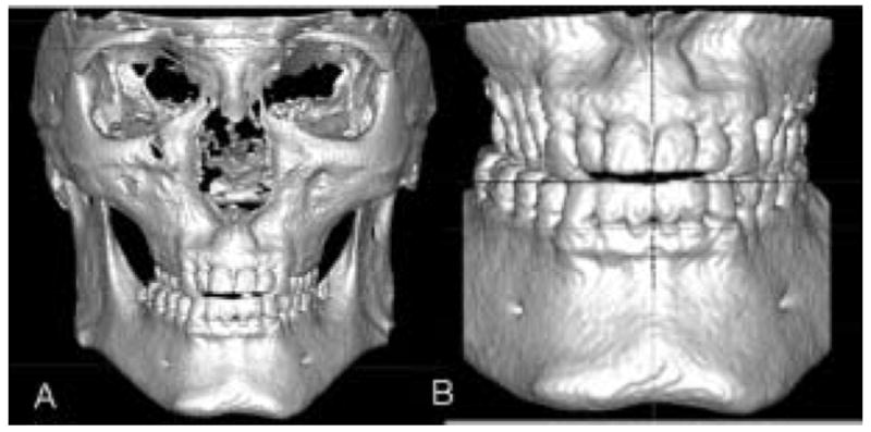 Fig 5