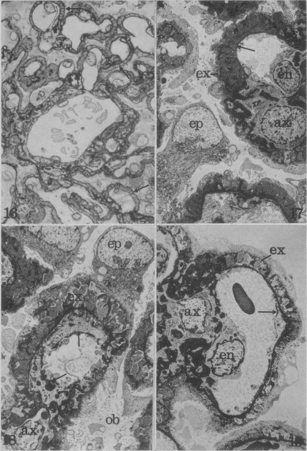 Figs. 16, 17, 18 and 19