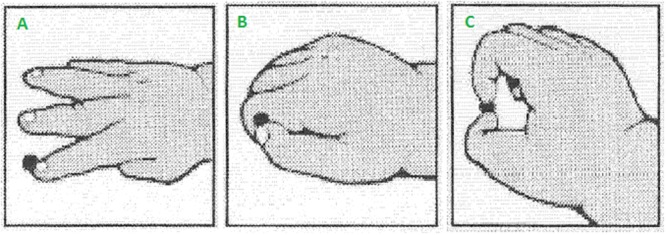 FIGURE 2