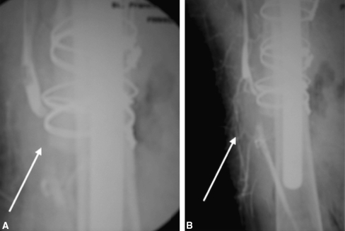 Fig. 2A–B