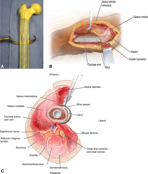 Fig. 5A–C