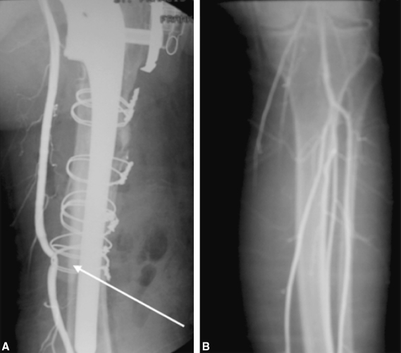 Fig. 3A–B