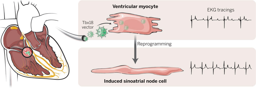 Biological pacemaker