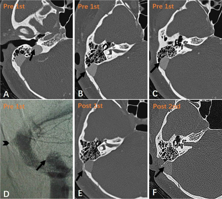 Figure 1. a-f.