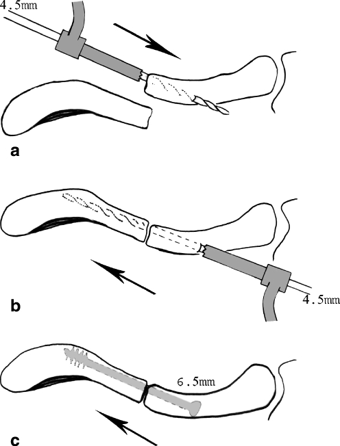 Fig. 1