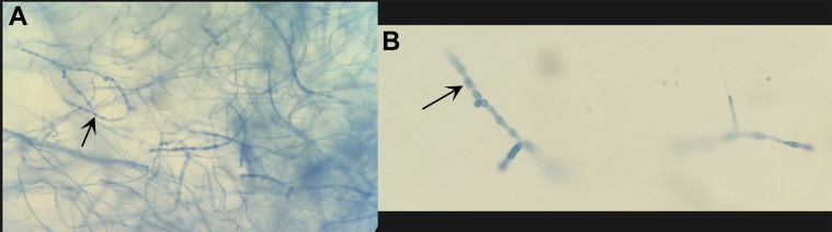 Fig. 5