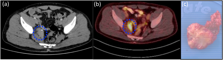 Fig. 1