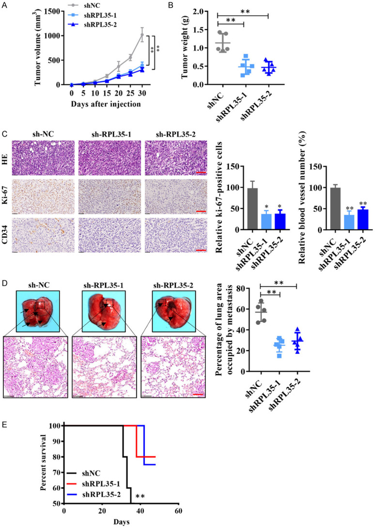 RPL35 promotes neuroblastoma progression via the enhanced aerobic ...