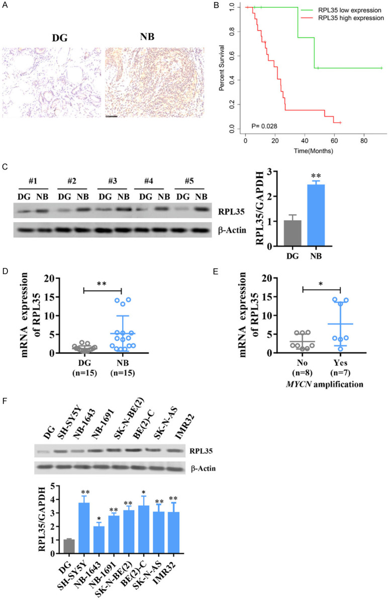 RPL35 promotes neuroblastoma progression via the enhanced aerobic ...