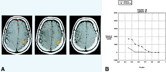 fig 1.