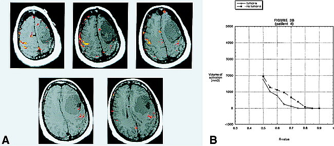 fig 3.