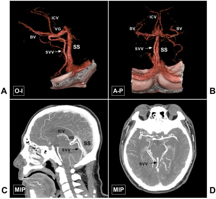 Figure 10