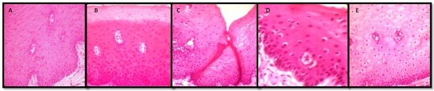 Figure 1: Photomicrograph of the tissues fixed in: A. Formalin, B. Honey, C. Sugar syrup, D. Molasses syrup, E. Distilled water (H & E, 40X)