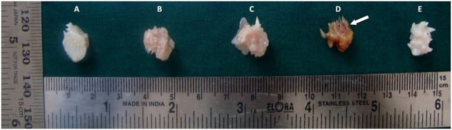 
Figure 3: Photograph of gross tissue specimens fixed in: A. Formalin, B. Honey, C. Sugar syrup, D. Jaggery syrup, E. Distilled water
