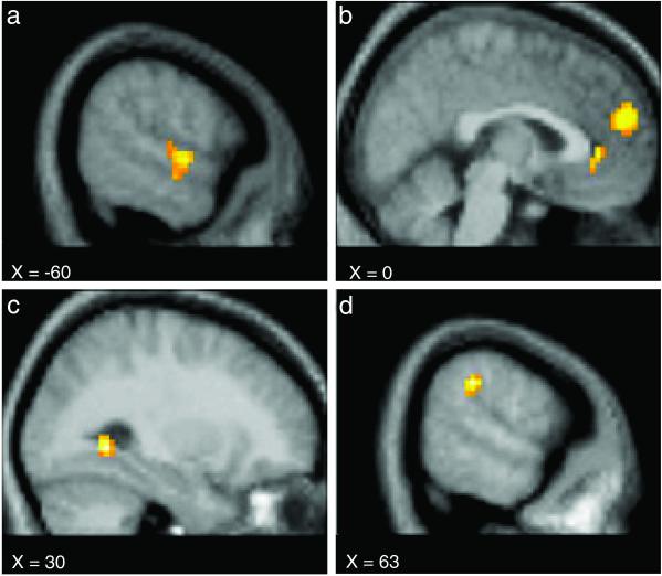 Fig 2.