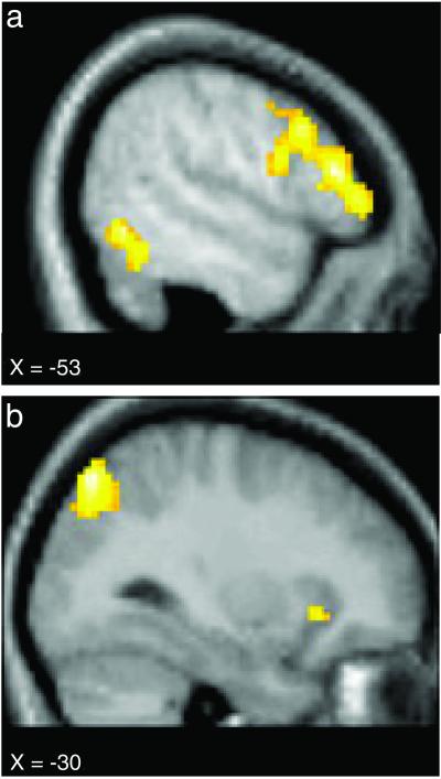 Fig 1.