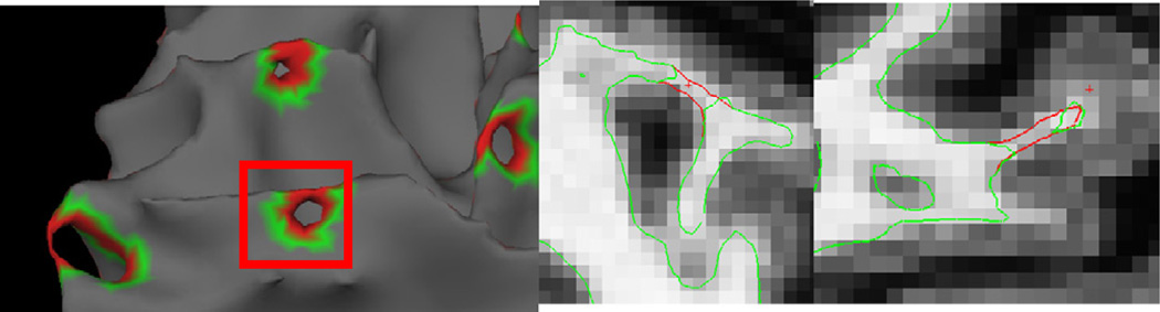 Fig. 5