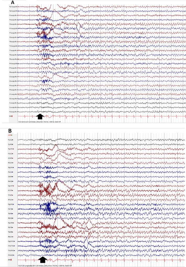 Fig. 11