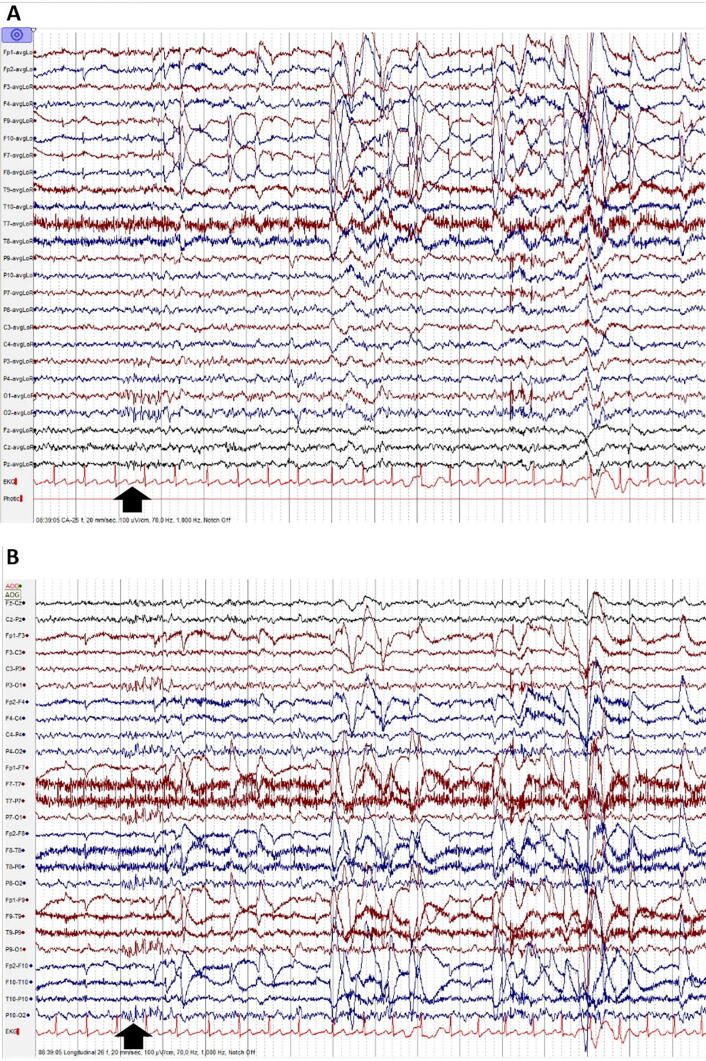 Fig. 10
