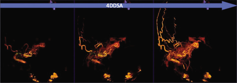 Figure 3: