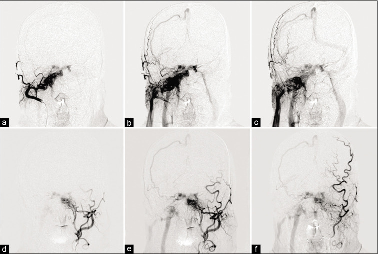 Figure 1: