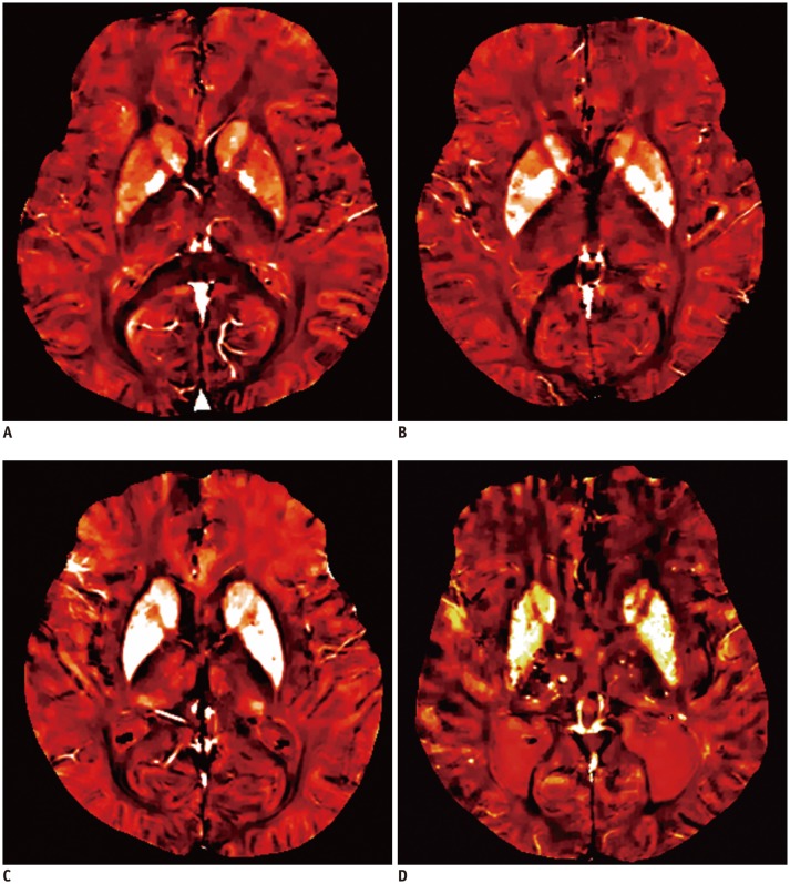 Fig. 12