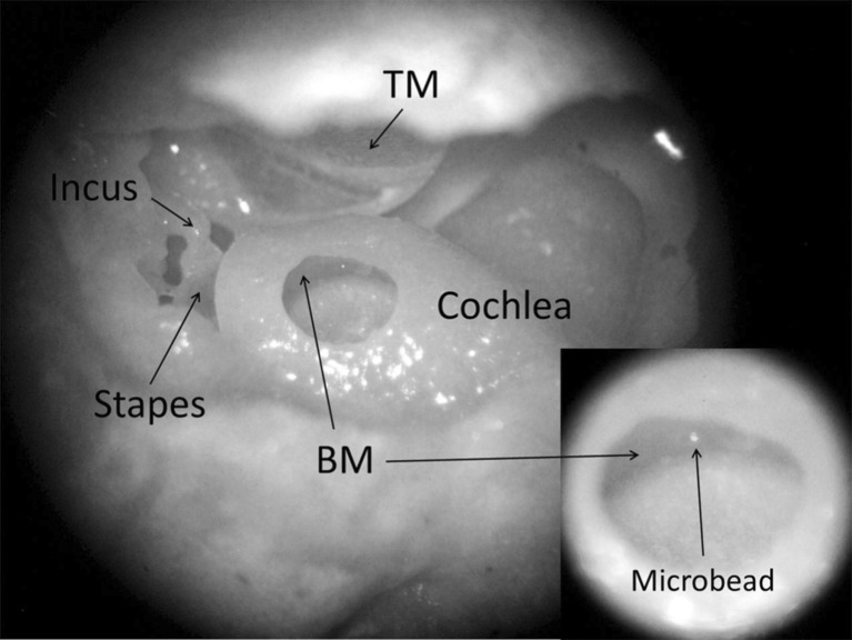 FIG. 1