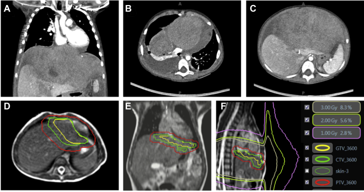 Fig. 1