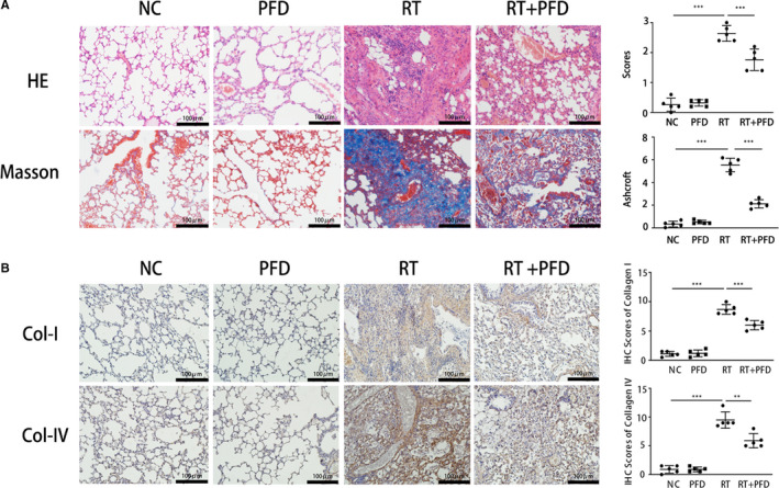 Pirfenidone modulates macrophage polarization and ameliorates radiation ...