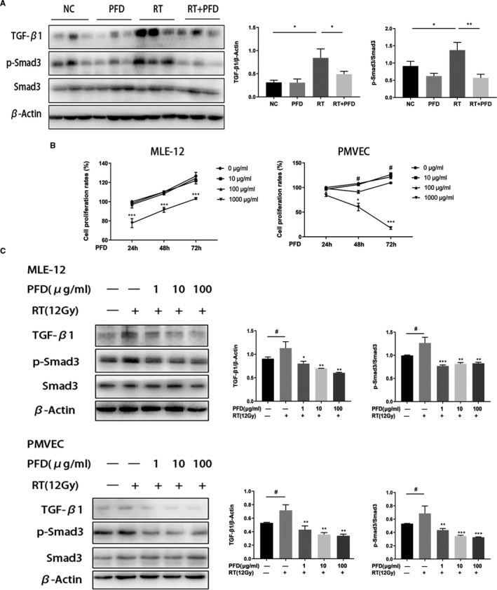 Pirfenidone modulates macrophage polarization and ameliorates radiation ...