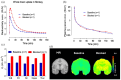 This image presents data from a study on a monkey, showing radioactivity uptake in the whole brain and specific regions under baseline and blocked conditions with [18F]JHU94620-d8. Whole brain uptake, plasma parent concentration, and total distribution volume in regions like pons, caudate, putamen, hippocampus, cerebellum, and cortex are depicted. MRI and PET images are included to visualize brain tissue and radiotracer distribution.