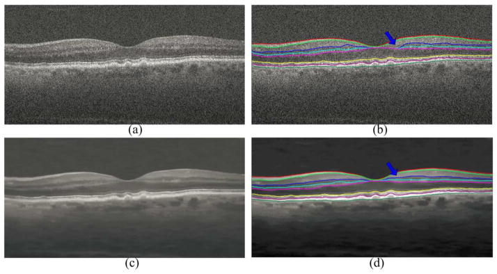 Fig. 11