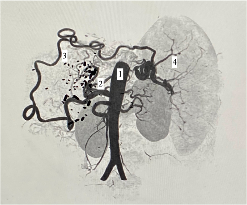 Figure 1