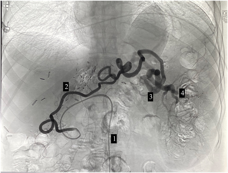 Figure 2