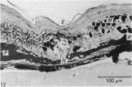 Fig. 12