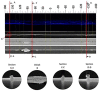 Figure 22