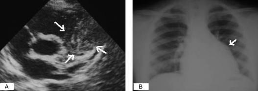 Figure 2)