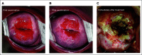 FIG 2