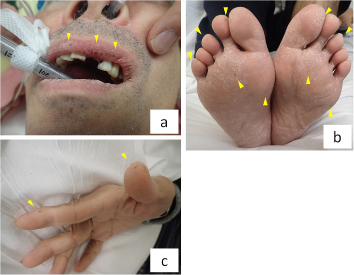 Fig. 2