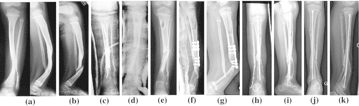 Fig. 3