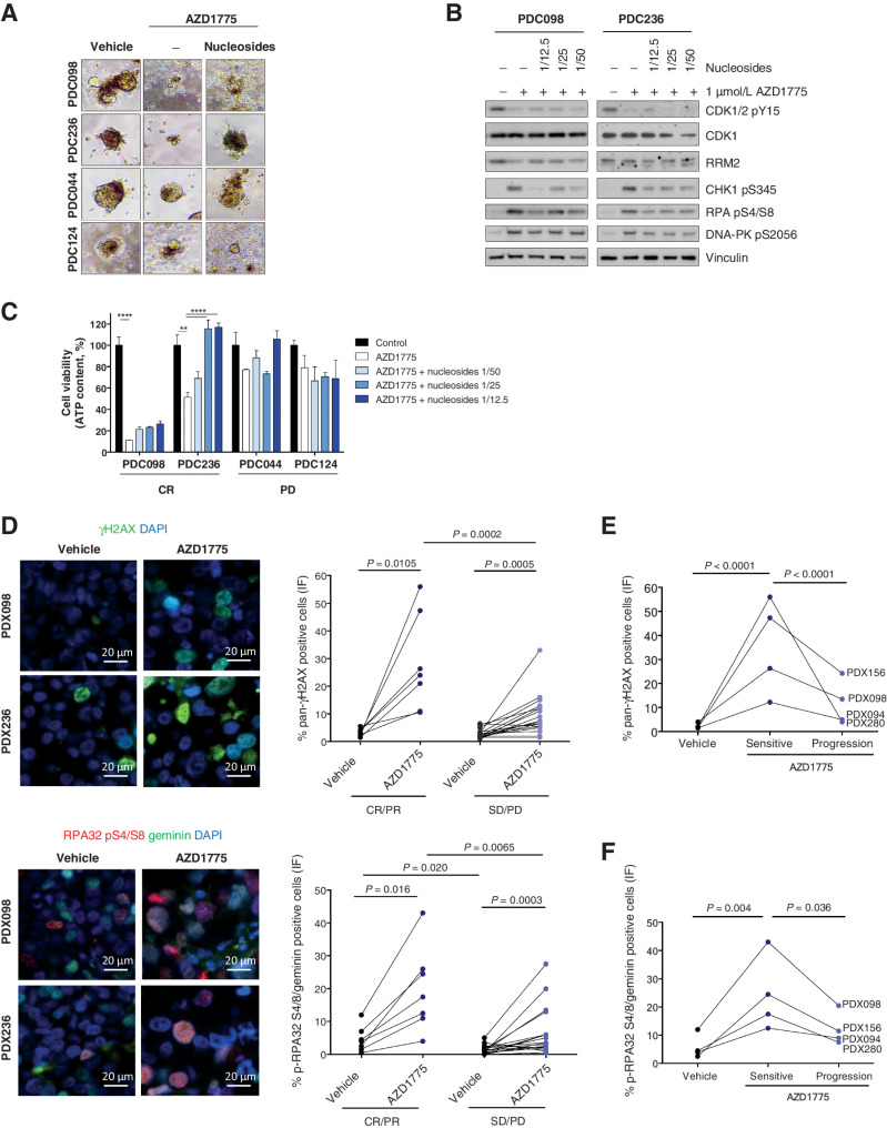 Figure 4. Shortage of dNTP induces sensitivity to AZD1775 in PDXs. A, Bright field images and quantification of the organoid area from PDC cultures treated for 72 hours with DMSO or 1 μmol/L AZD1775, in the presence (+) or absence (−) of nucleosides (Embryomax, 1:12.5 dilution). B, Immunoblot analysis of DDR and RSR biomarkers in two AZD1775-sensitive models, PDC098 and PDC236, treated with 1 μmol/L AZD1775 in the presence (+) or absence (−) of nucleosides at the indicated dilution for 6 hours. C, Representative immunofluorescence images of two AZD1775-sensitive PDX models (PDX098 and PDX236) and quantification of the percentage of cells exhibiting pan-nuclear γH2AX staining in seven AZD1775-sensitive and nineteen AZD1775-resistant PDXs. D, Representative immunofluorescence images of two AZD1775-sensitive PDX models (PDX098 and PDX236) and quantification of the percentage of cells in S/G2-phase (geminin-positive) with pRPA nuclear foci in seven AZD1775-sensitive and nineteen AZD1775-resistant PDXs. Each dot represents the mean of at least two independent tumors per PDX model. All pictures were taken at 600× magnification. E and F, show quantifications of pan-nuclear γH2AX staining and pRPA nuclear foci in four models with acquired resistance to AZD1775.