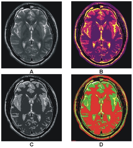 Figure 13