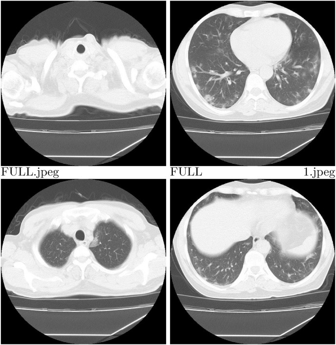 Fig. 2