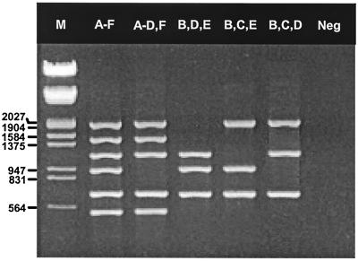 FIG. 1