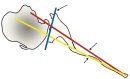 Fig. (1)