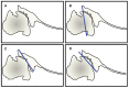 Fig. (2)