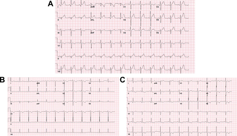 Fig. 2