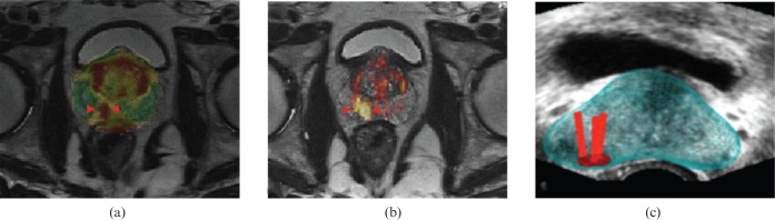 Figure 17