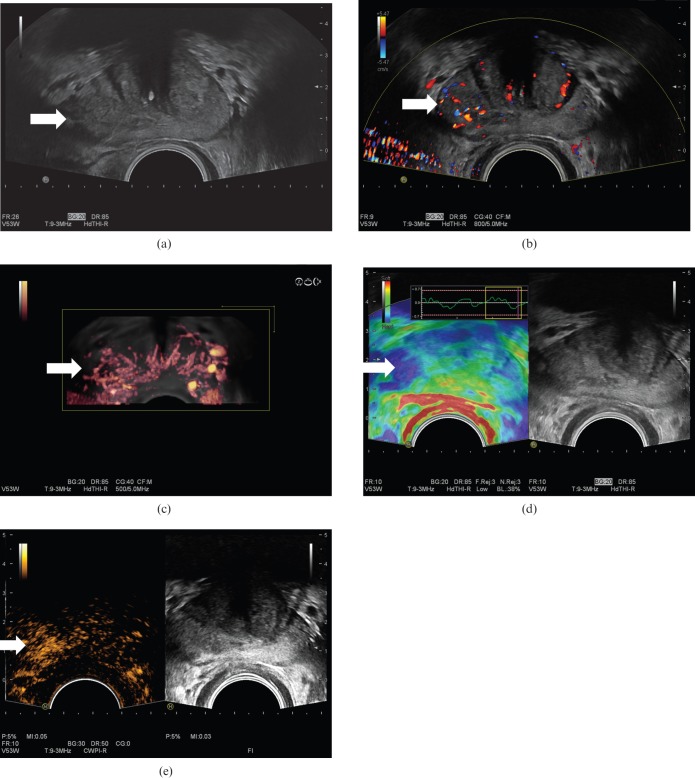 Figure 12