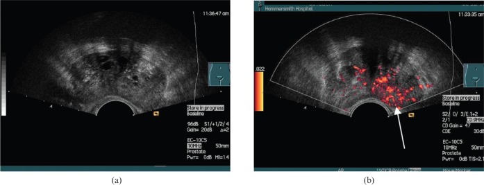 Figure 11